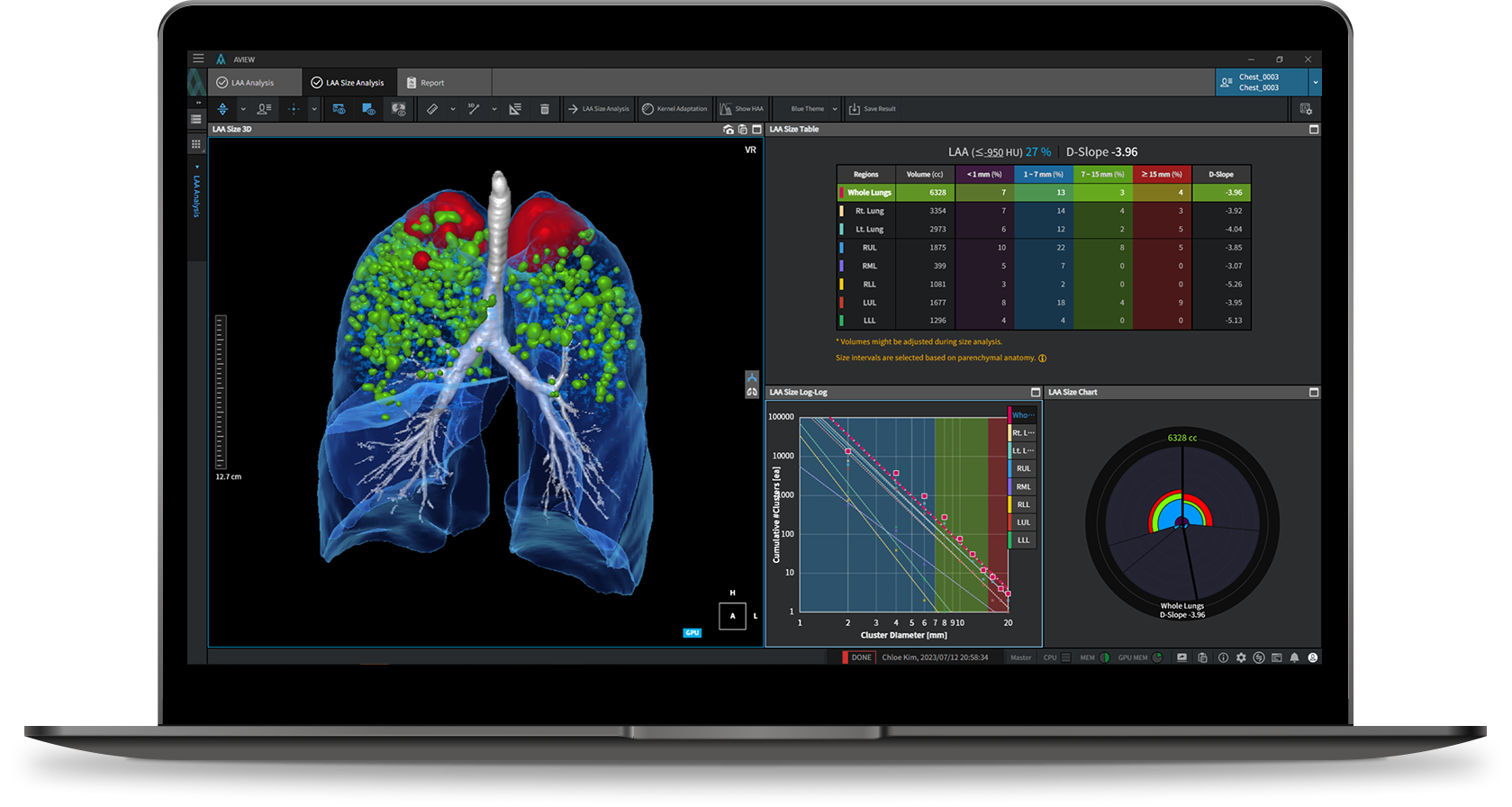 aview COPD