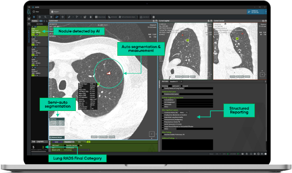 aview LCS PLUS