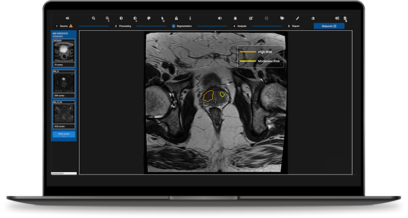 QP-Prostate