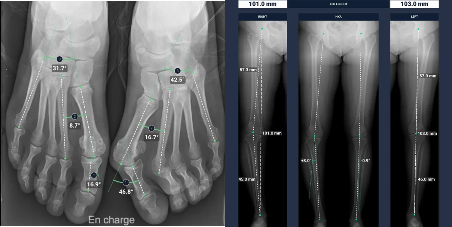 BoneMetrics