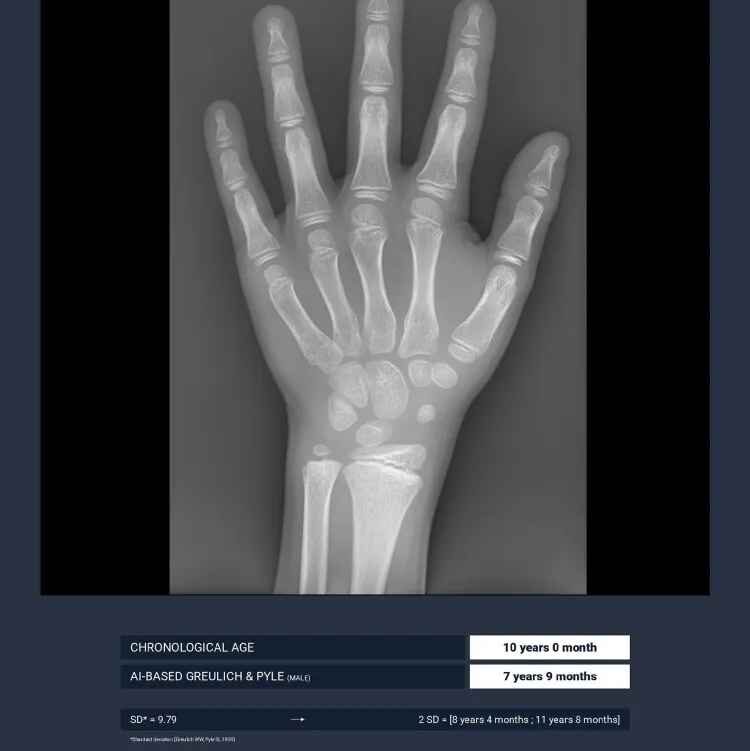 BoneView BoneAge